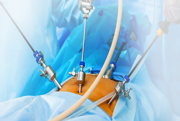 Laparoscopic Surgery