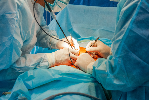 Gynaecology Surgery